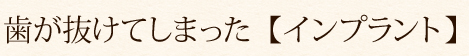 歯が抜けてしまった【インプラント】